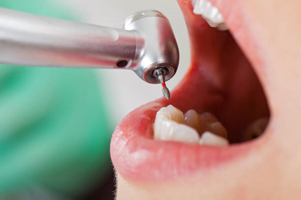 Best Emergency Dental Care for Abscessed Tooth in Amesti, CA